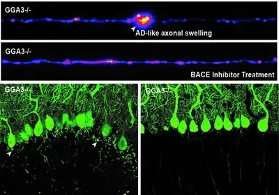 bace1 alzheimer's disease gga3 axon neuron